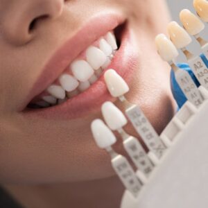 facings bij een vrouw